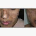 Understanding Scarring: What You Need to Know About Plastic Surgery Risks and Recovery